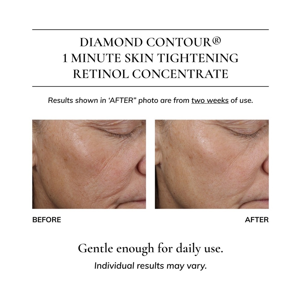 🎀 Kaplan MD Diamond Contour Retinol Concentrate 50ml ✨ Brand New In Box 🎀 - Picture 4 of 10